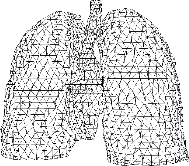 all lung contours joined in a 3D model