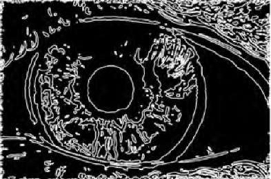 Canny edge detection of eye